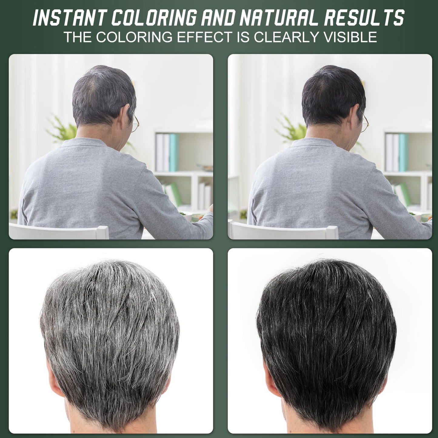 ✨Clinclii®  Hair Dye Cream, Covers Gray & Nourishes